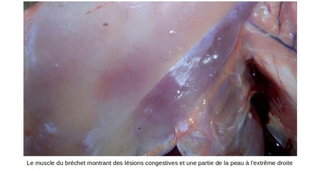 bréchet avec tissu sous cutané